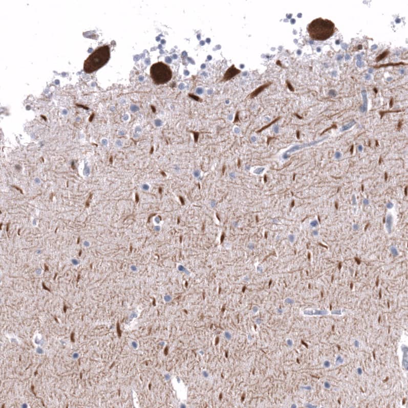 Staining of human cerebellum shows strong cytoplasmic positivity in Purkinje cells.