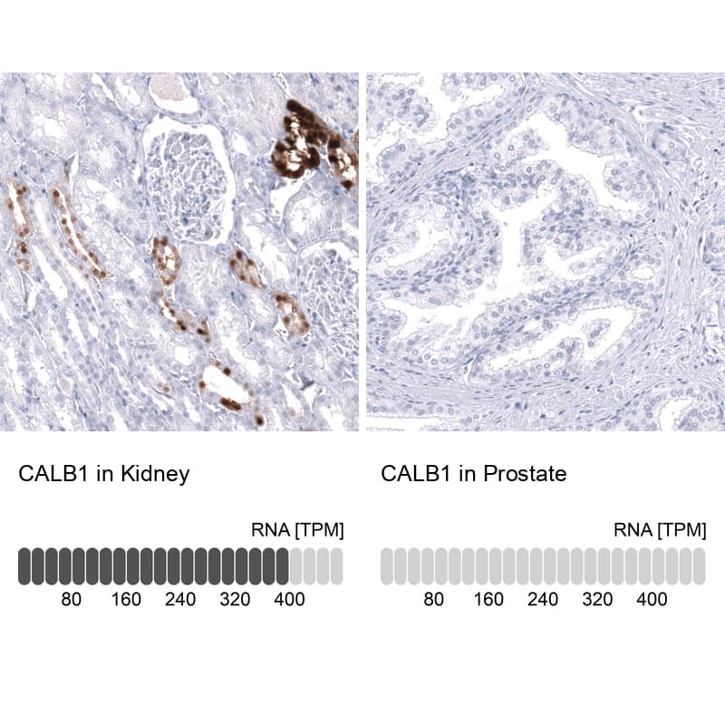 <b>Orthogonal Strategies Validation. </b>Analysis in human kidney and prostate tissues using NBP3-43648 antibody. Corresponding CALB1 RNA-seq data are presented for the same tissues.