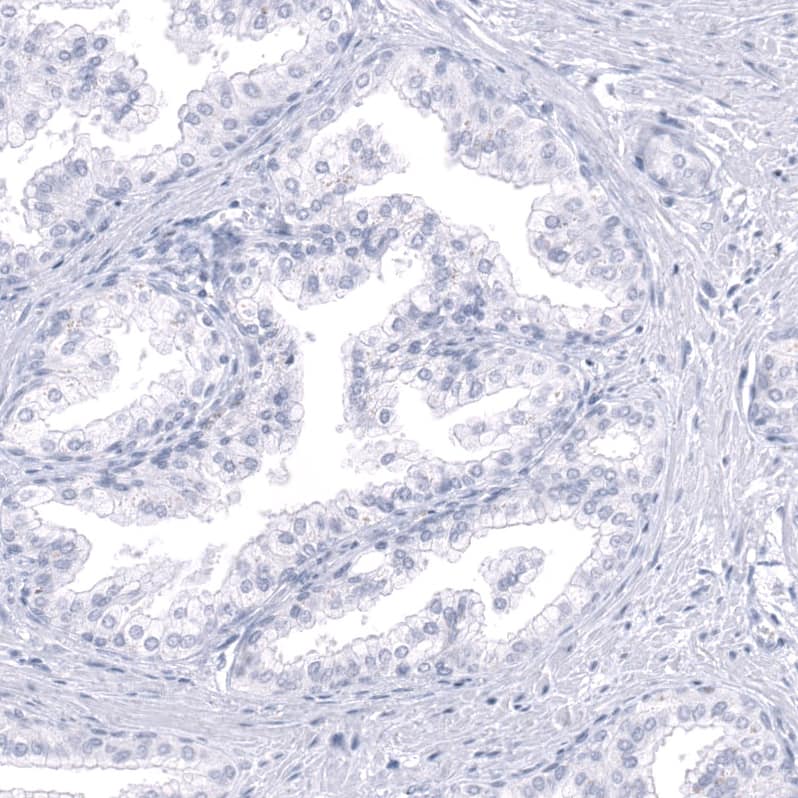 Staining of human prostate shows no positivity in glandular cells as expected.