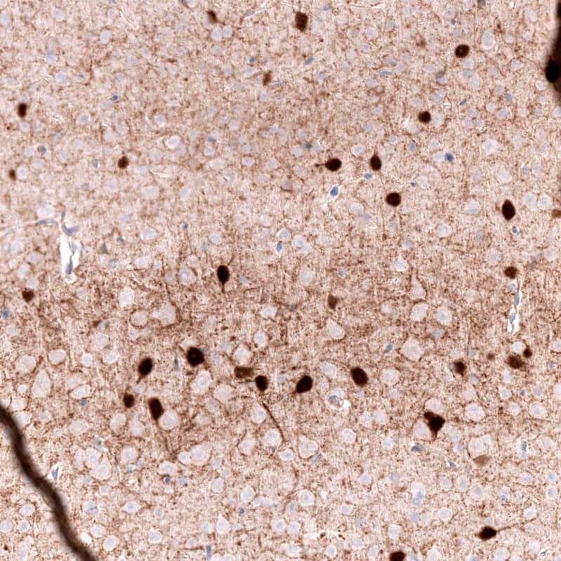 Staining of mouse cerebral cortex shows strong cytoplasmic positivity in neurons.