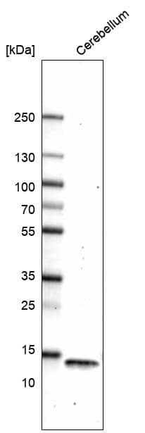 Analysis in human cerebellum tissue.