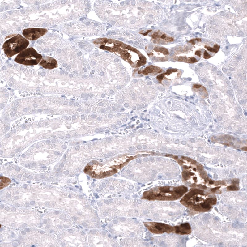 Staining of human kidney shows strong cytoplasmic positivity in cells in tubules.