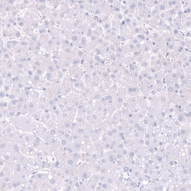 Staining of human liver shows no positivity in hepatocytes as expected.