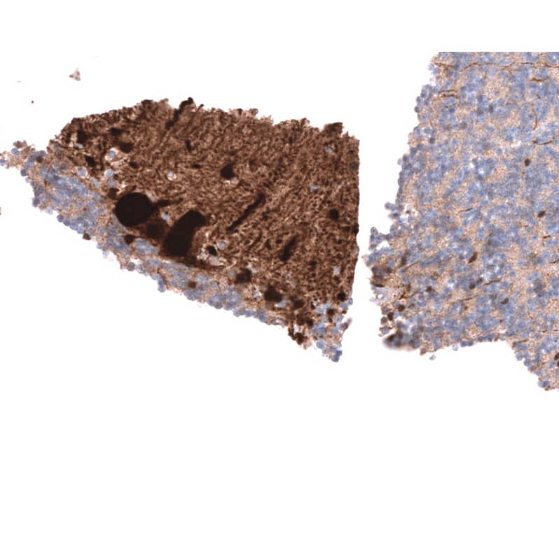 Staining of human cerebellum shows strong cytoplasmic positivity in Purkinje cells.