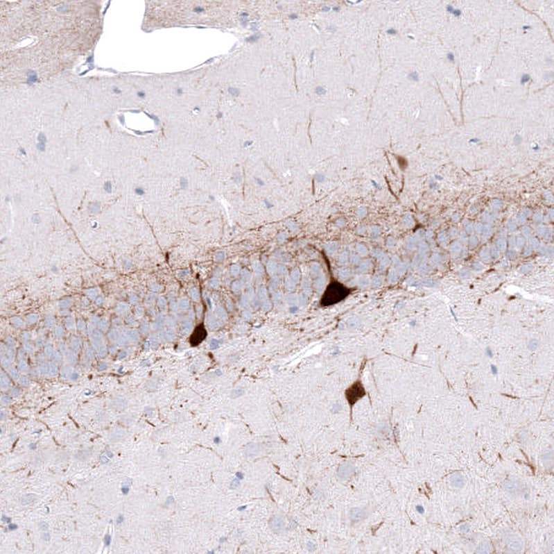 Staining of rat hippocampus shows strong cytoplasmic positivity in a subset of neurons.