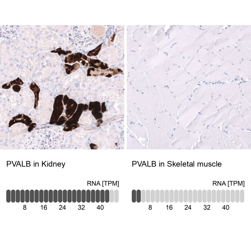 Analysis in human kidney and skeletal muscle tissues using NBP3-43650 antibody. Corresponding PVALB RNA-seq data are presented for the same tissues.