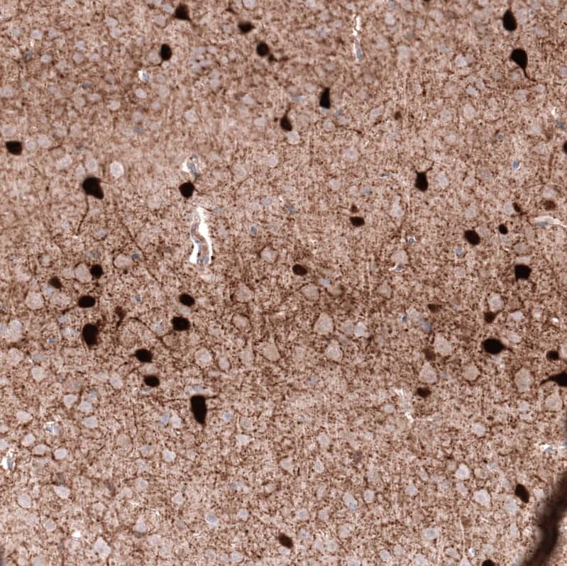 Staining of mouse cerebral cortex shows strong cytoplasmic positivity in a subset of neurons.