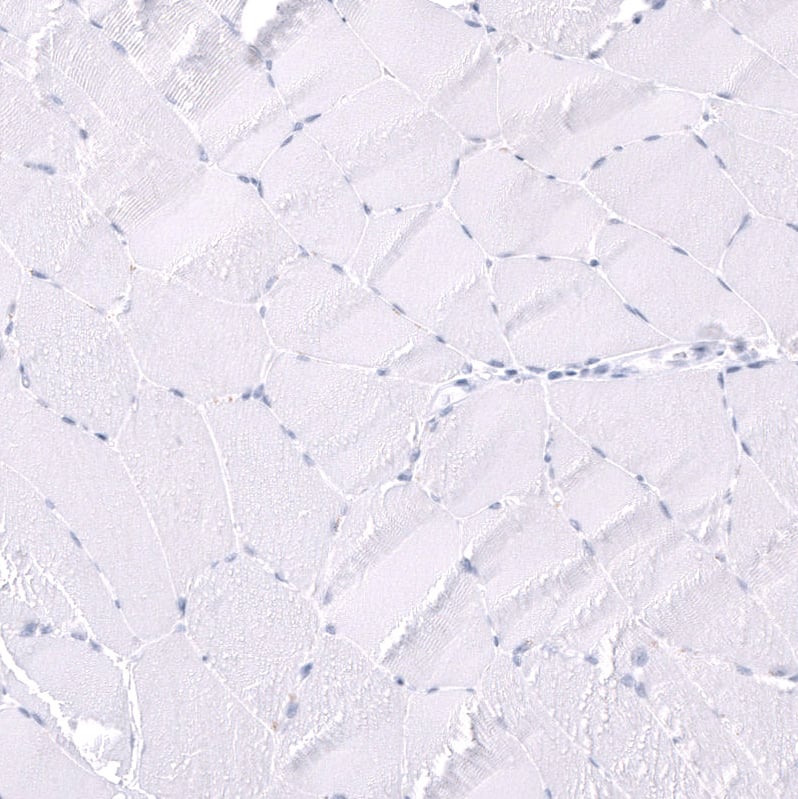 <b>Orthogonal Strategies Validation. </b>Staining of human skeletal muscle shows no positivity in myocytes as expected.