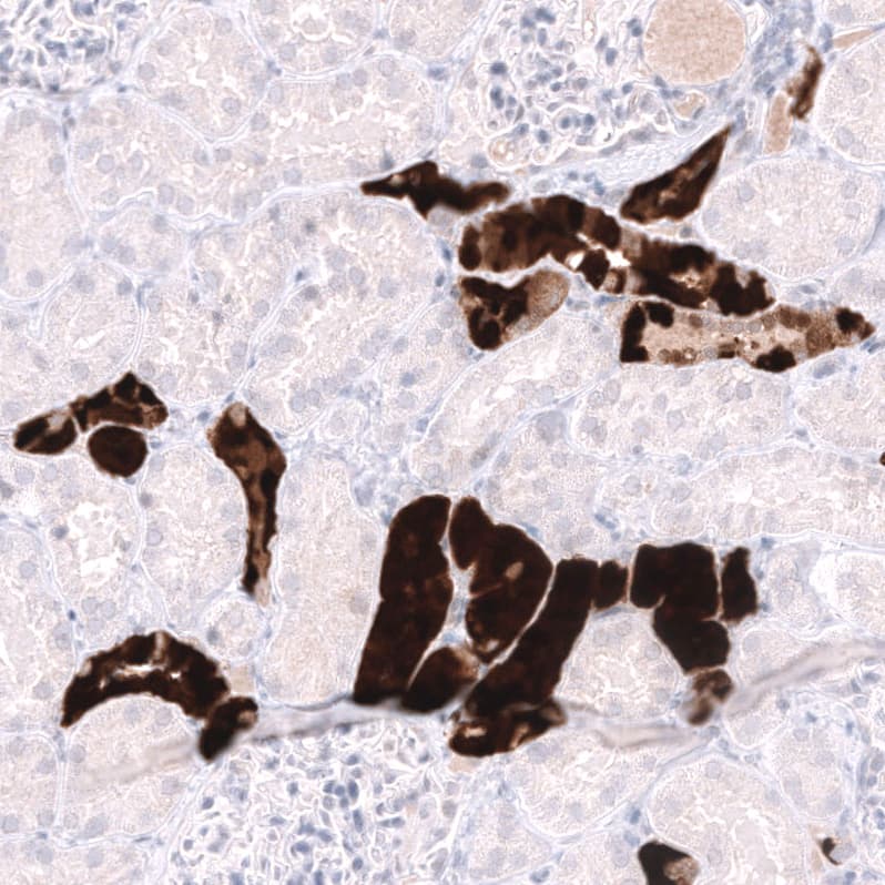 Staining of human kidney shows strong cytoplasmic positivity in cells in tubules.