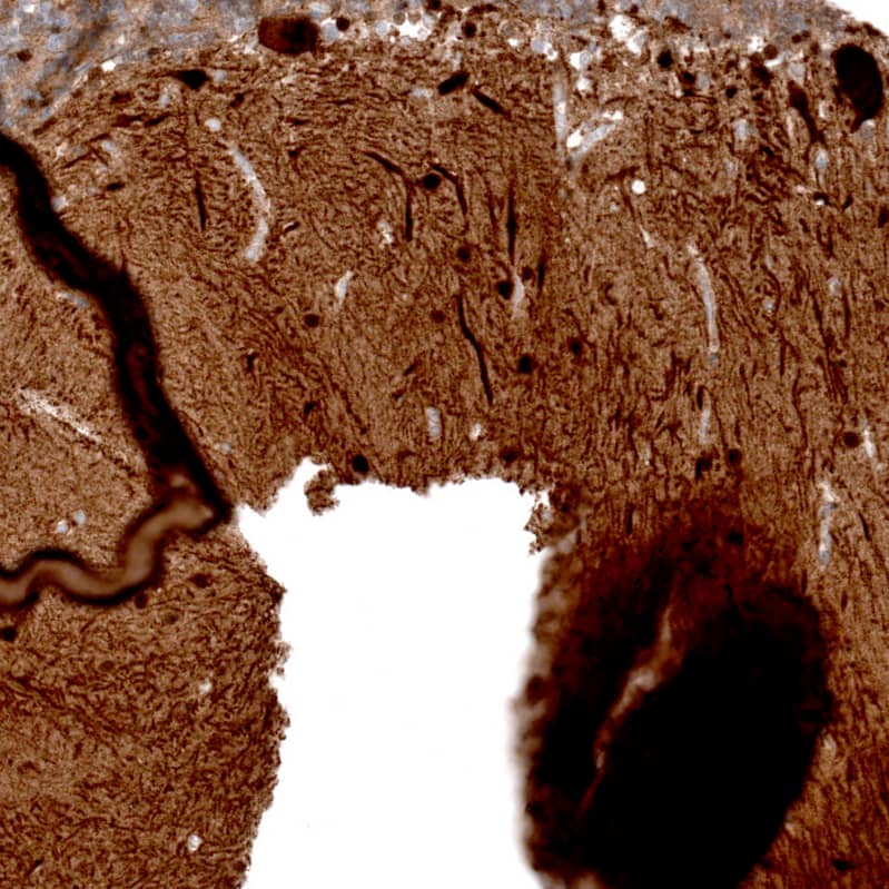 Staining of human cerebellum shows strong cytoplasmic positivity in Purkinje cells.