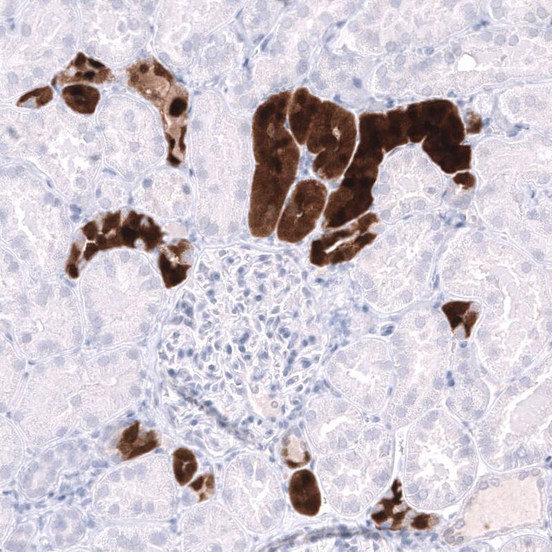 Staining of human kidney shows strong cytoplasmic positivity in cells in tubules.