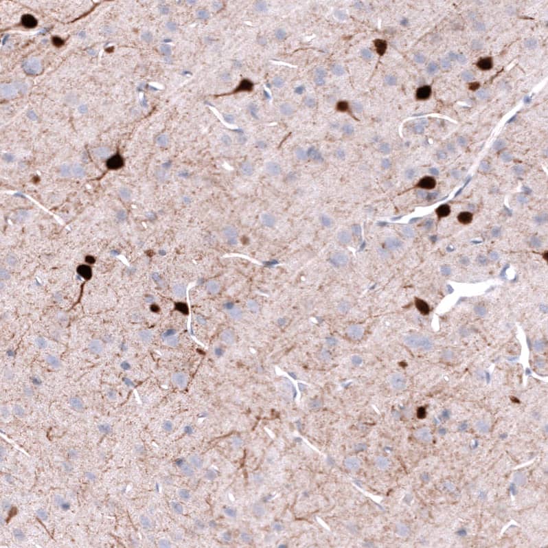 Staining of rat cerebral cortex shows strong cytoplasmic positivity in neurons.