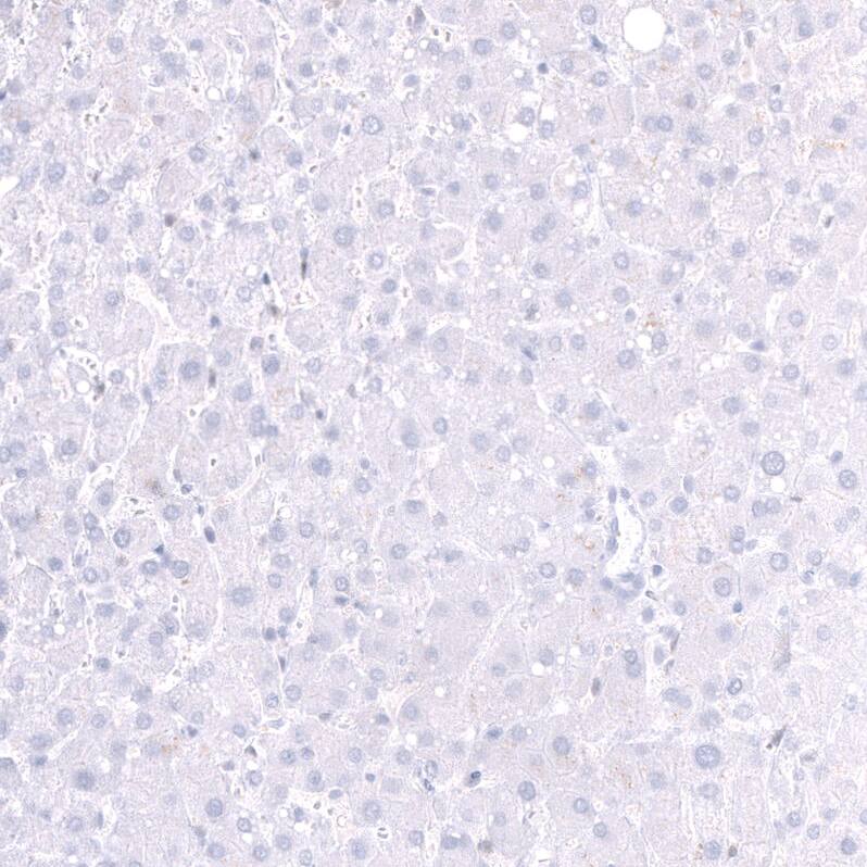 Staining of human liver shows no positivity in hepatocytes as expected.