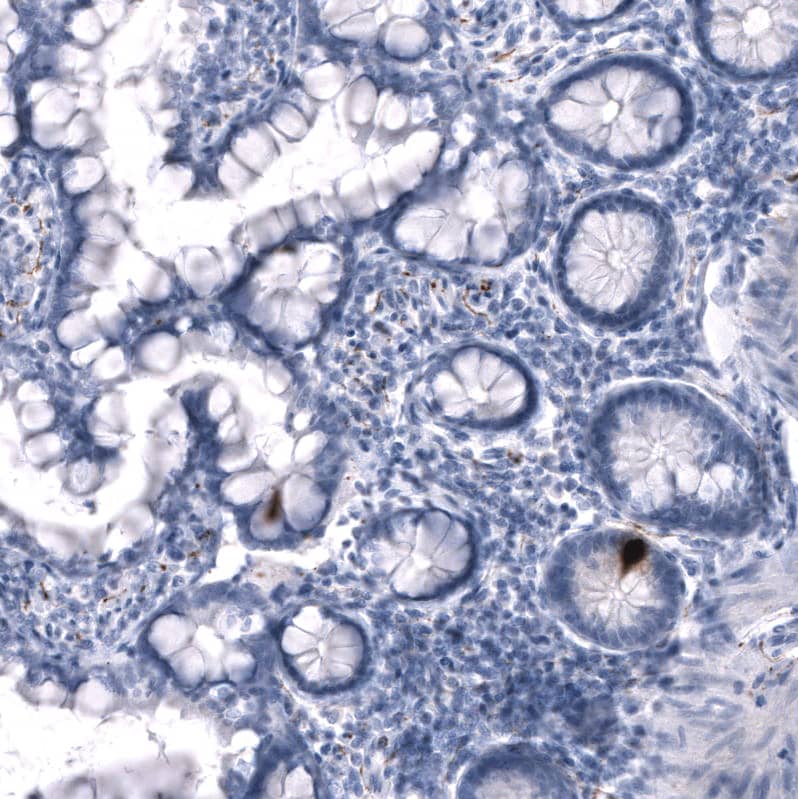 Staining of human small intestine shows strong cytoplasmic positivity in enteroendocrine cells.