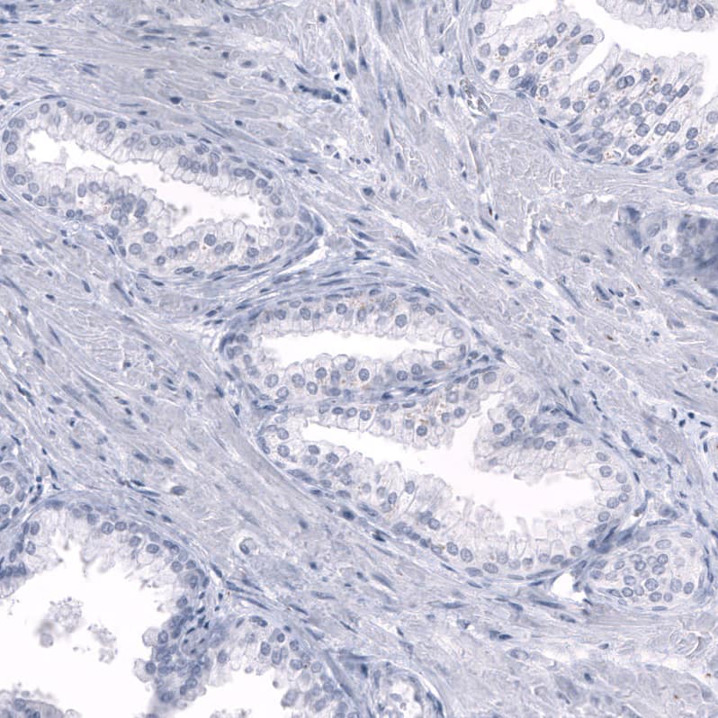 Staining of human prostate shows no positivity in glandular cells as expected.