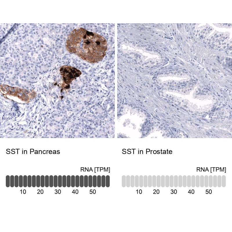 <b>Orthogonal Strategies Validation. </b>Analysis in human pancreas and prostate tissues using NBP3-43652 antibody. Corresponding SST RNA-seq data are presented for the same tissues.