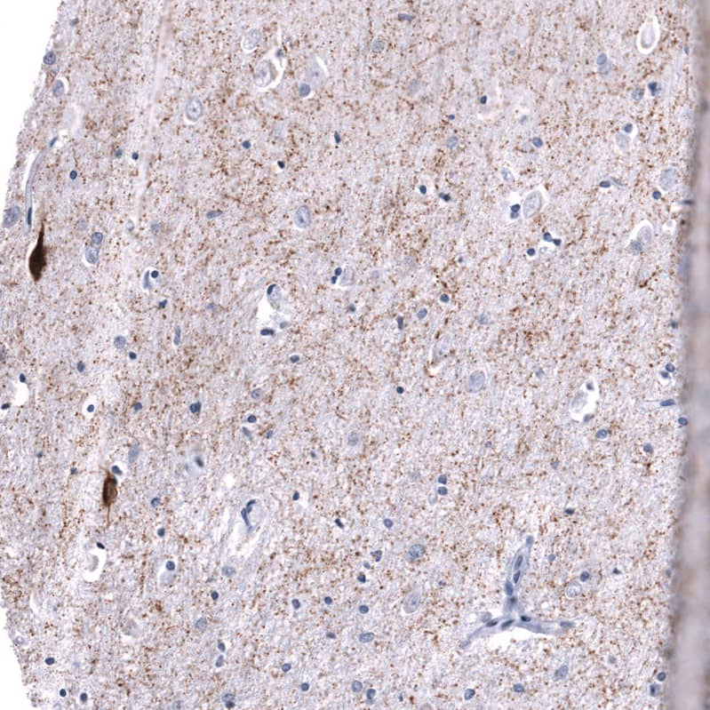 Staining of human cerebral cortex shows moderate to strong cytoplasmic positivity in a subset of neurons and in neuronal processes.