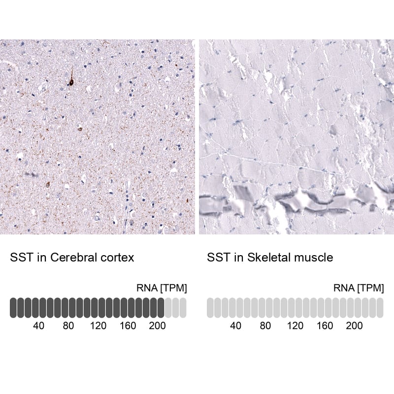 <b>Orthogonal Strategies Validation. </b>Analysis in human cerebral cortex and skeletal muscle tissues using NBP3-43653 antibody. Corresponding SST RNA-seq data are presented for the same tissues.