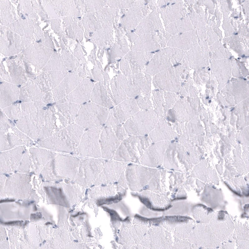 Staining of human skeletal muscle shows no positivity in myocytes as expected.