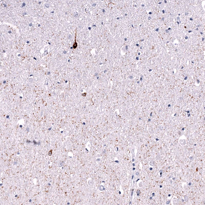 Staining of human cerebral cortex shows strong cytoplasmic positivity in a subset of neurons and neuronal processes.