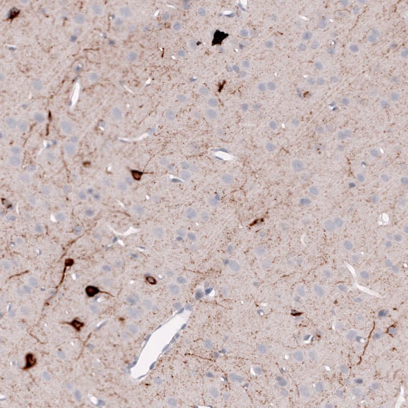 Staining of rat cerebral cortex shows strong cytoplasmic positivity in neurons and neuronal processes.