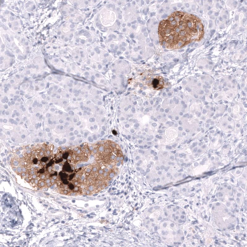 Staining of human pancreas shows moderate to strong cytoplasmic positivity in islets of Langerhans.