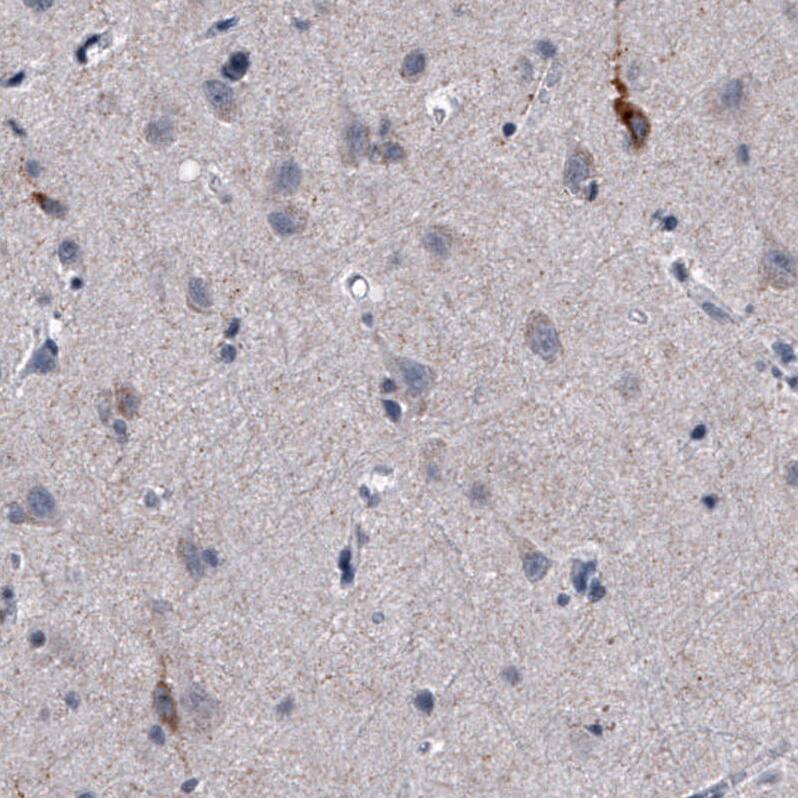 Immunohistochemistry-Paraffin Nociceptin Antibody (CL15085) [Unconjugated]