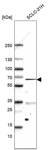 Western Blot ETV1 Antibody (CL15251) [Unconjugated] - BSA Free