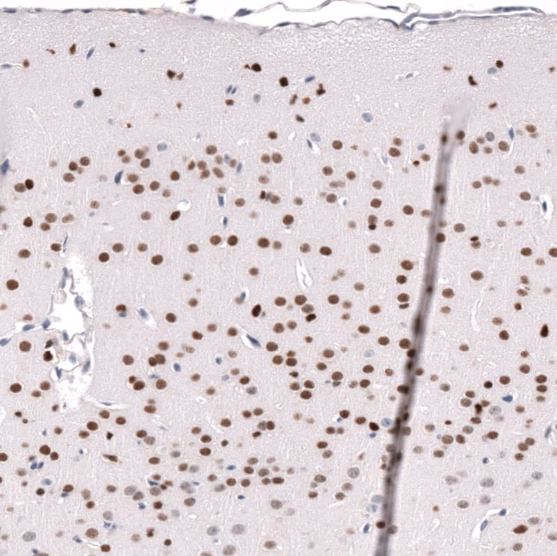 Staining of mouse cerebral cortex shows strong nuclear positivity in neurons.