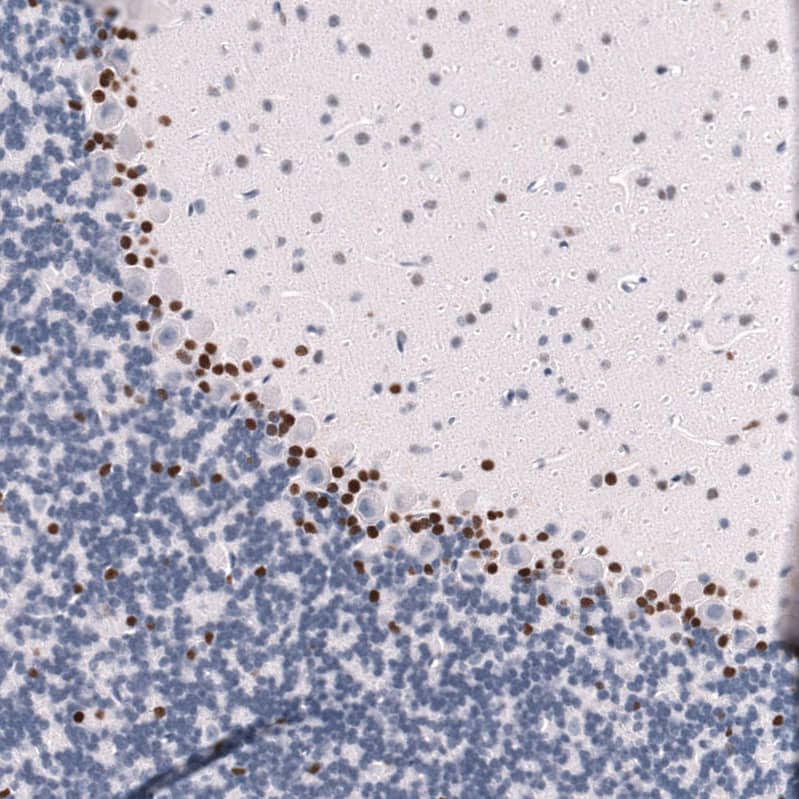 Staining of mouse cerebellum shows strong nuclear positivity in a subset of neurons.