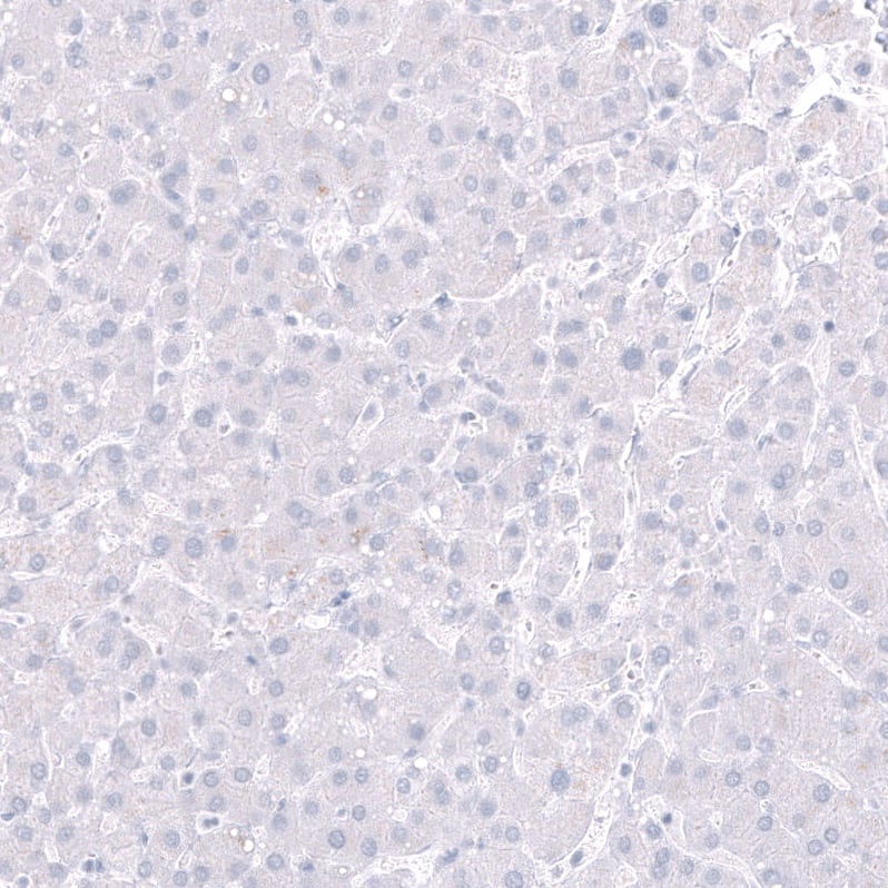 Staining of human liver shows no positivity in hepatocytes as expected.