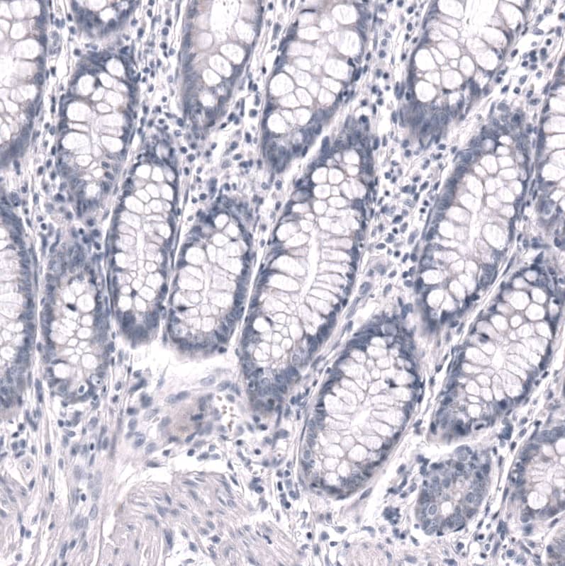 Staining of human rectum shows no positivity in glandular cells as expected.