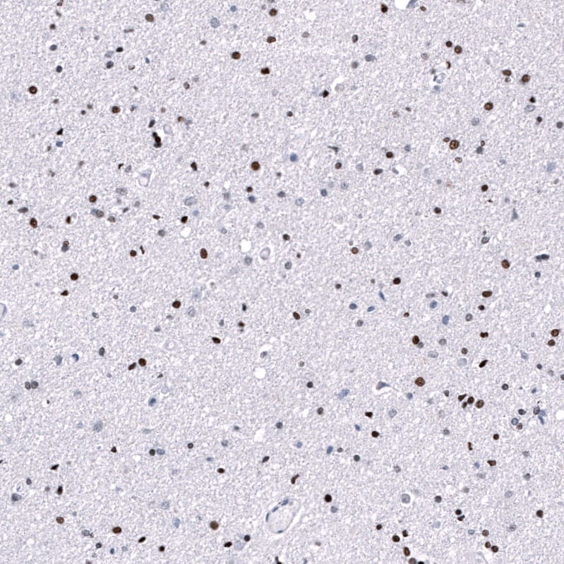 Staining of human cerebral cortex shows strong nuclear positivity in neurons and glial cells.