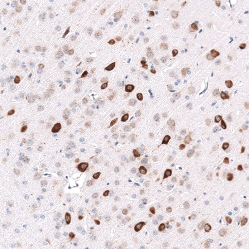 Immunohistochemistry-Paraffin ELAVL2 Antibody (CL15323) [Unconjugated]