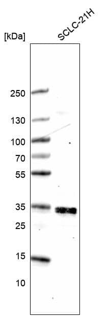 Analysis in human cell line SCLC-21H.