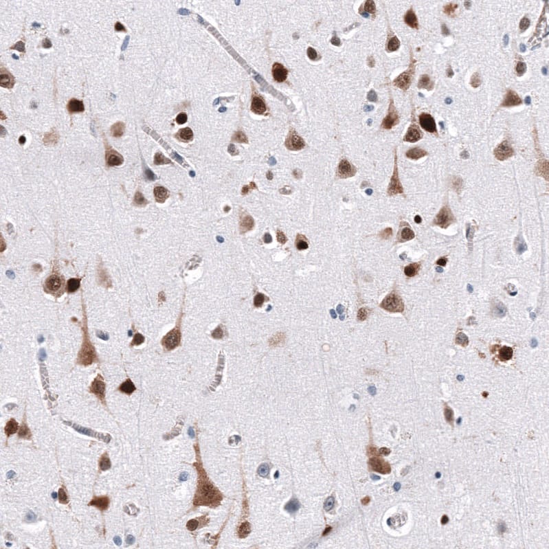 Staining of human cerebral cortex shows strong cytoplasmic positivity in neurons.