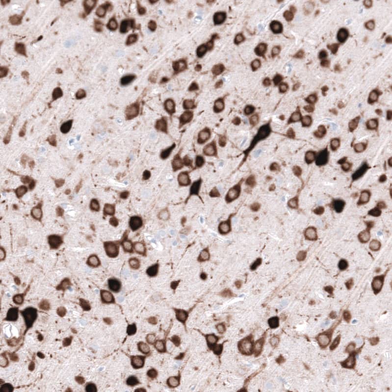Staining of rat cerebral cortex shows strong cytoplasmic positivity in neurons.