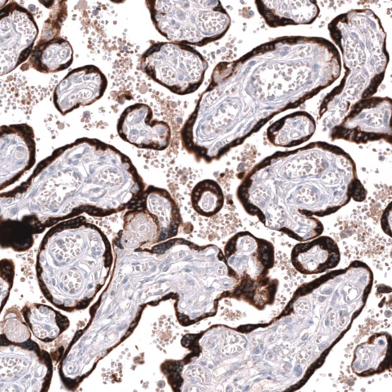 Staining of human placenta shows strong cytoplasmic positivity in trophoblastic cells.