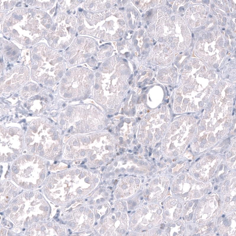 Staining of human kidney shows no positivity in cells in tubules as expected.