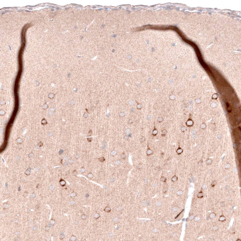 Staining of rat cerebral cortex shows moderate cytoplasmic positivity in a subset of neurons in the upper layers.