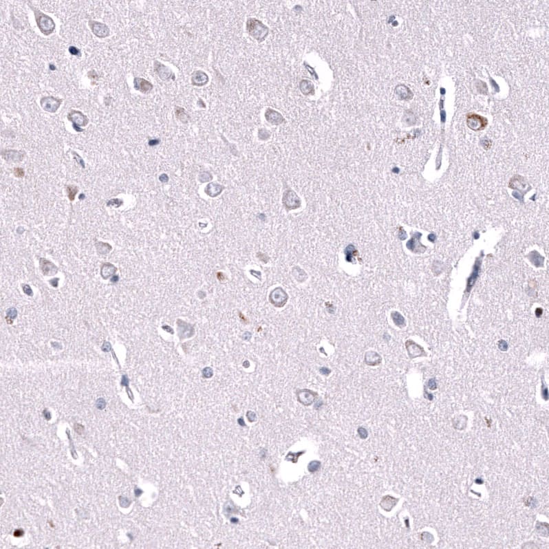 Staining of human cerebral cortex shows weak to moderate cytoplasmic positivity in a subset of neurons.