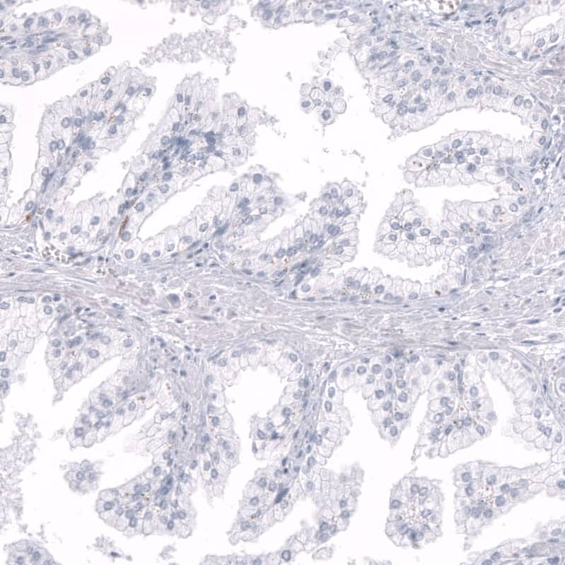 <b>Orthogonal Strategies Validation. </b>Staining of human prostate shows no positivity in glandular cells as expected.