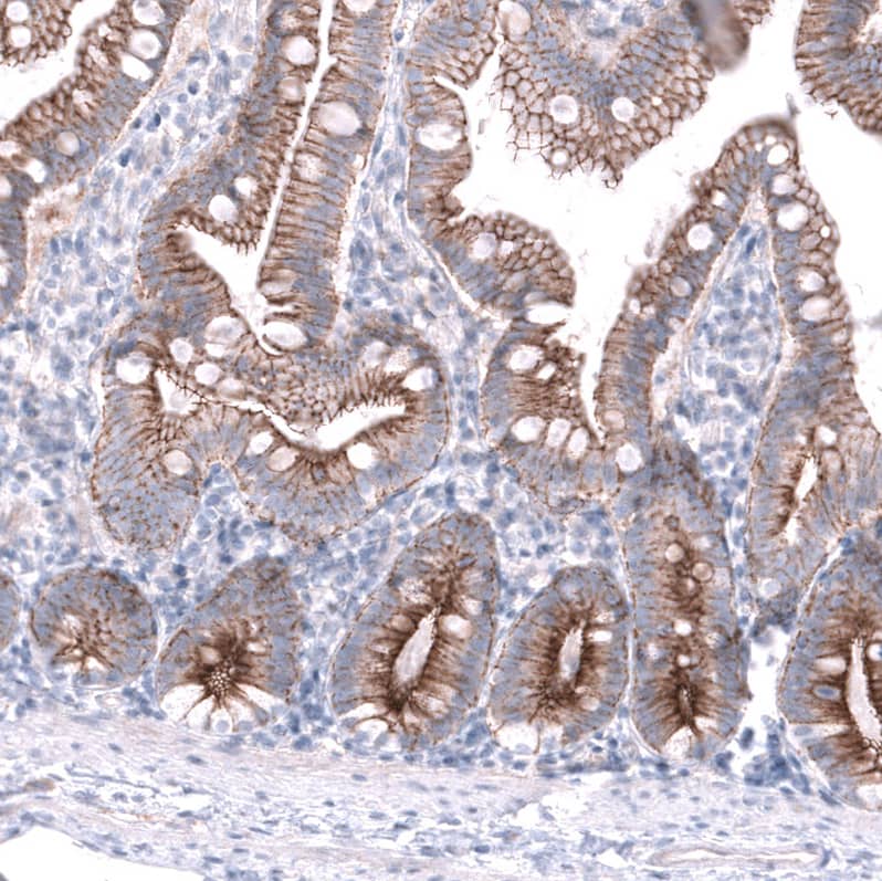 Staining of human duodenum shows moderate to strong membranous positivity in glandular cells.