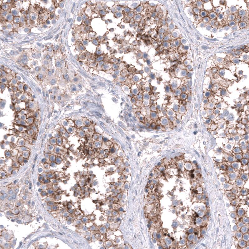 Staining of human testis shows moderate to strong membranous positivity in cells in seminiferous ducts.