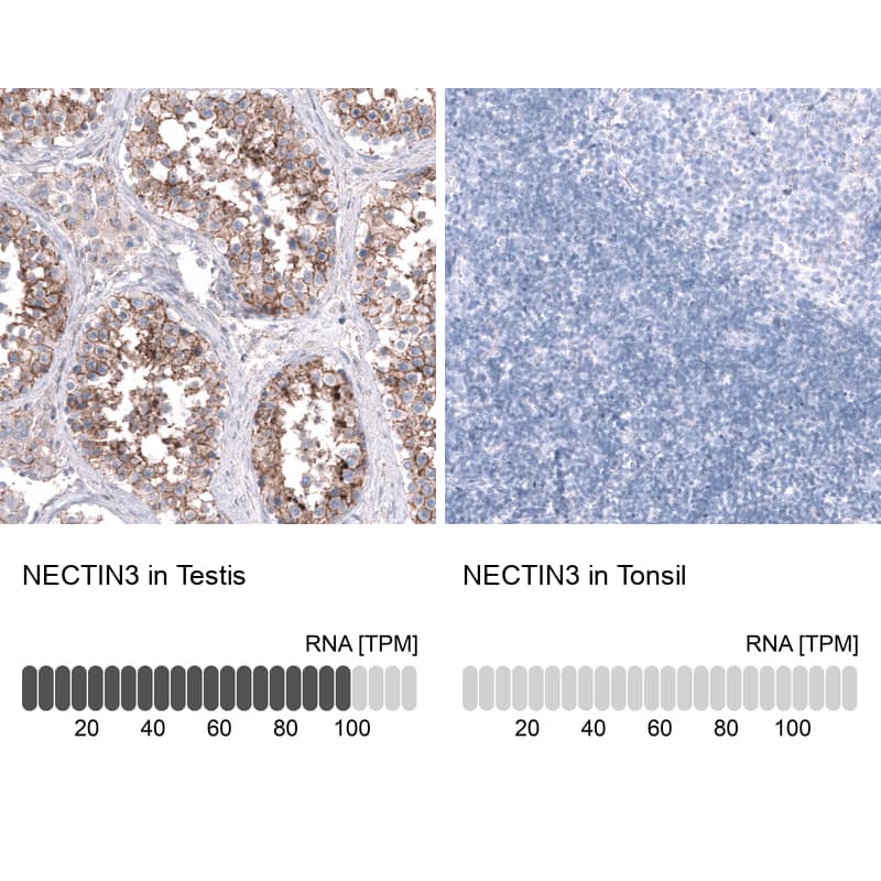 <b>Orthogonal Strategies Validation. </b>Analysis in human testis and tonsil tissues using NBP3-43664 antibody. Corresponding NECTIN3 RNA-seq data are presented for the same tissues.