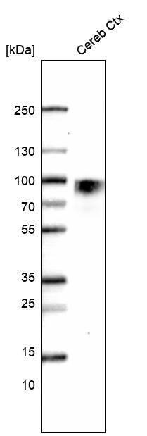 Analysis in human cerebral cortex tissue.