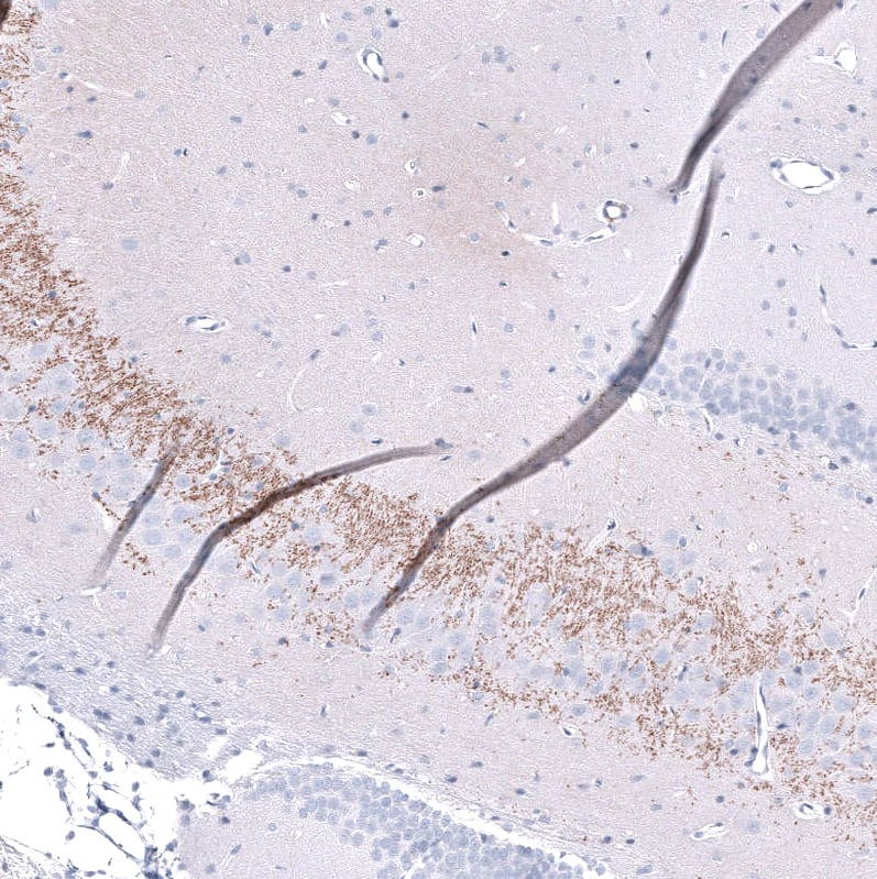 Staining of rat brain shows moderate positivity in neuronal processes in the CA3 area of the hippocampus.