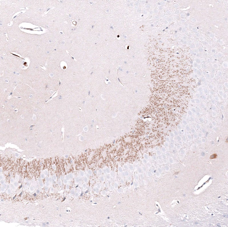 Staining of mouse brain shows moderate positivity in neuronal processes in the CA3 area of the hippocampus.