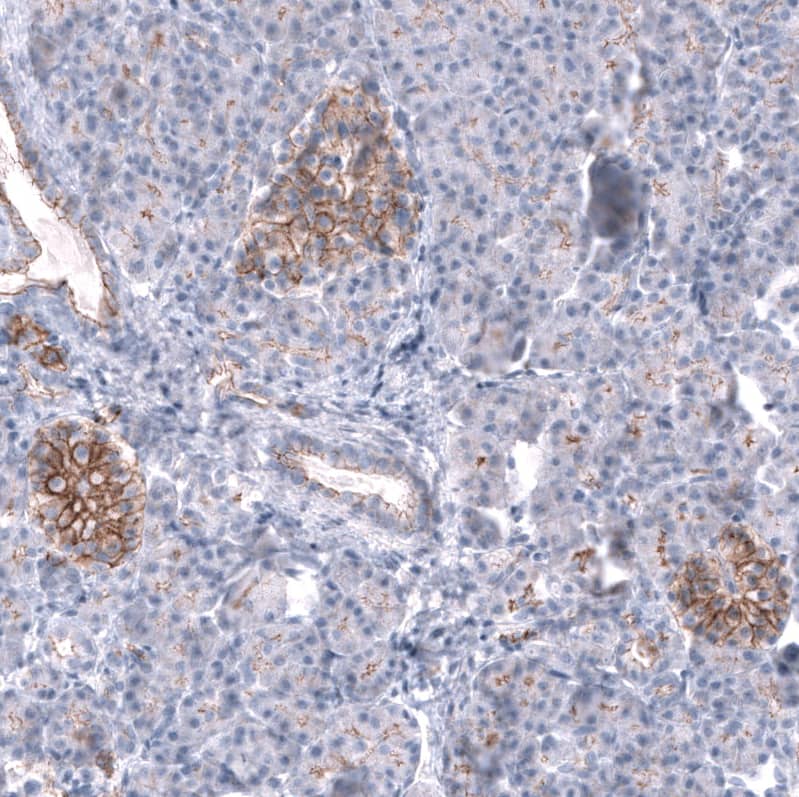 Staining of human pancreas shows  moderate membranous positivity in the islets of Langerhans.