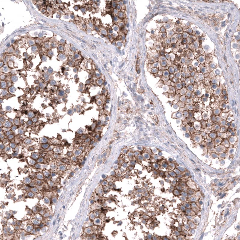 Staining of human testis shows strong membranous positivity in cells in seminiferous ducts.